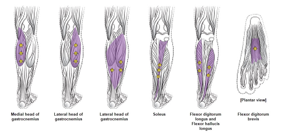 BOTOX SmPC _P7_image v3